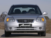 Hyundai Accent Hatchback 5-door. (LC) 1.5 TDI MT (83hp) avis, Hyundai Accent Hatchback 5-door. (LC) 1.5 TDI MT (83hp) prix, Hyundai Accent Hatchback 5-door. (LC) 1.5 TDI MT (83hp) caractéristiques, Hyundai Accent Hatchback 5-door. (LC) 1.5 TDI MT (83hp) Fiche, Hyundai Accent Hatchback 5-door. (LC) 1.5 TDI MT (83hp) Fiche technique, Hyundai Accent Hatchback 5-door. (LC) 1.5 TDI MT (83hp) achat, Hyundai Accent Hatchback 5-door. (LC) 1.5 TDI MT (83hp) acheter, Hyundai Accent Hatchback 5-door. (LC) 1.5 TDI MT (83hp) Auto